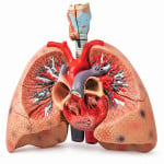 Heart with Lungs and Larynx